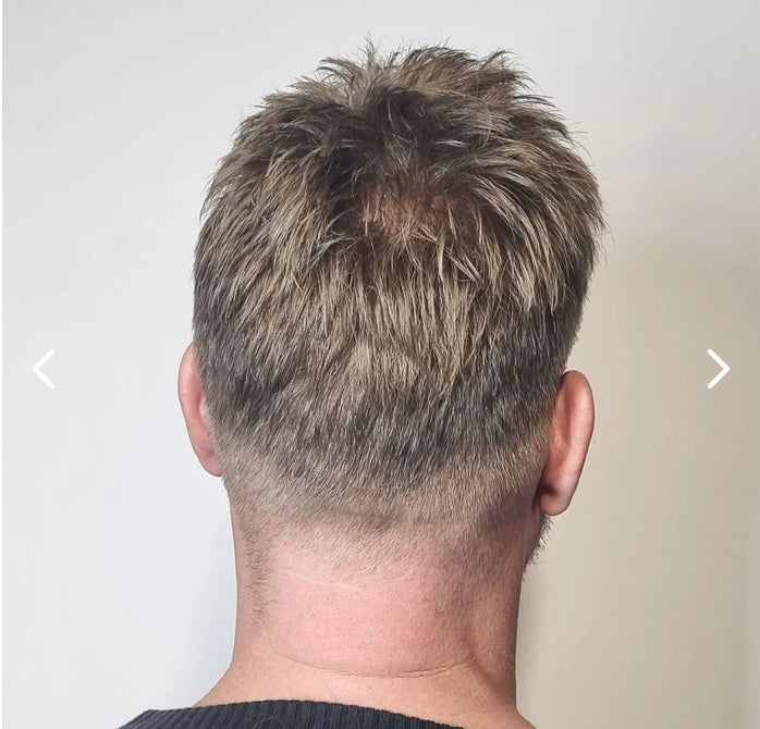 HOLLYWOOD: Lace Hair System With Thin Skin Perimeter and Lace Front